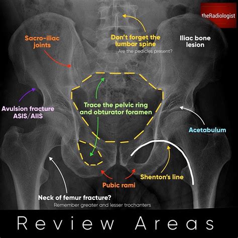 Pelvis X Ray Anatomy