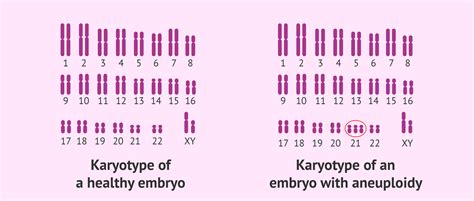 What is embryonic aneuploidy?