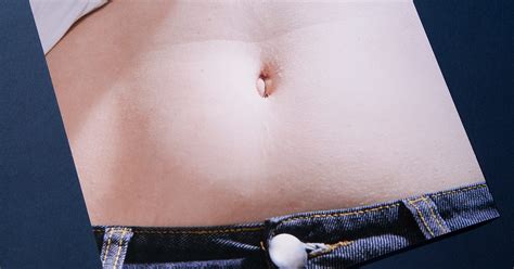 Belly Button Yeast Infection - Tribuntech