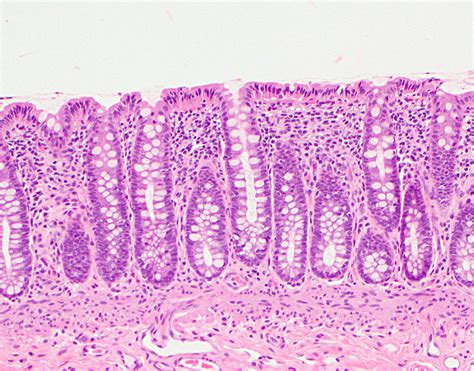 Taenia Coli Histology