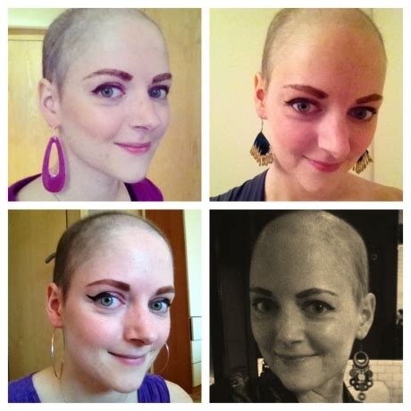 Chemotherapy Hair Loss Timeline