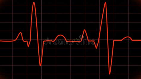 EKG animation heartbeat stock video. Video of listening - 39110377