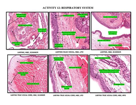 Laryngeal Ventricle Histology