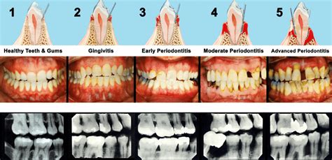 Periodontal Disease is No Joke: Lynn A. Livingston, DDS: Dentist