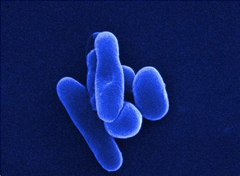 Scanning electron microscope shows shape variation in M. tuberculosis ...