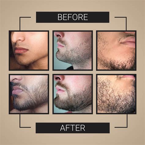 Beard Growth Serum – Crafted Beards