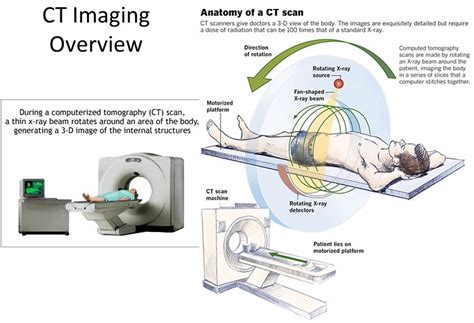 Circuit Diagram Of Ct Scan Machine