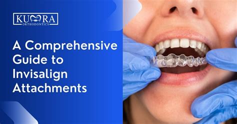 A Comprehensive Guide to Invisalign Attachments | Kumra Orthodontics