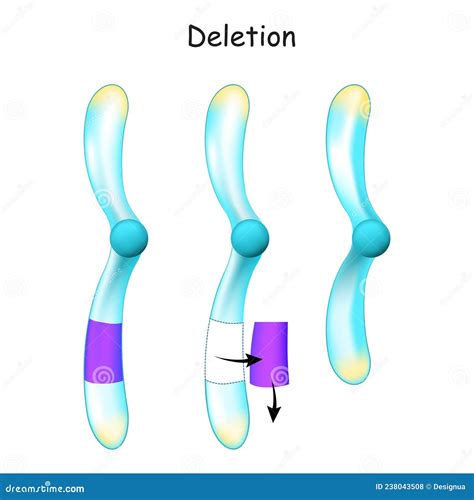 Chromosome Deletion. Genetic Mutation Stock Vector - Illustration of medical, education: 238043508