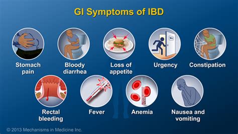 Slide Show - Diagnosing IBD