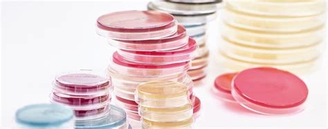 Agar Plates Archives - Advancells Group