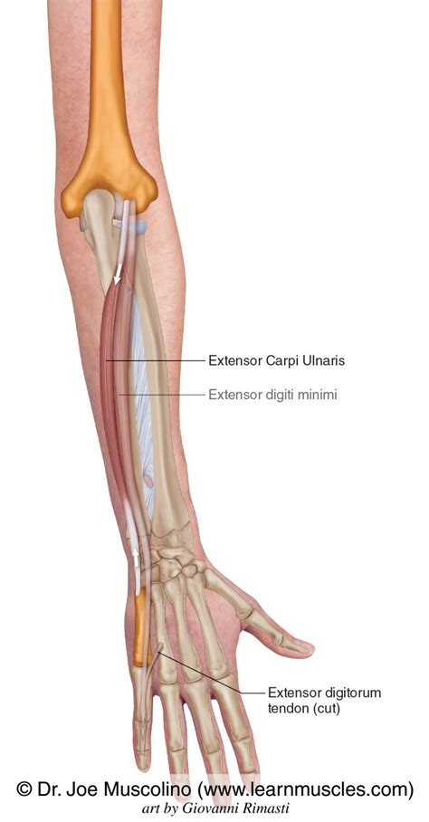 Extensor Carpi Ulnaris - Learn Muscles