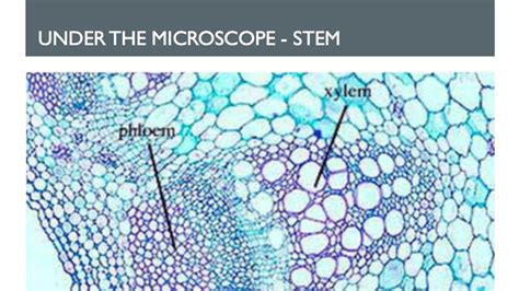 Xylem And Phloem Under Microscope