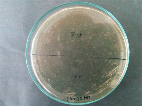 Why when I incubate Pseudomonas in medium with cetrimide for 10 days do I get the following ...