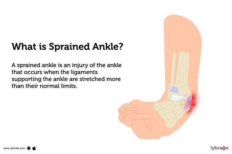 Sprain On Ankle Of Foot Online | emergencydentistry.com