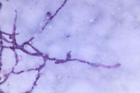 Dimorphic Fungi | Definition, Types & Examples - Video & Lesson Transcript | Study.com