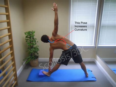 Scoliosis Yoga Exercises | Blog Dandk