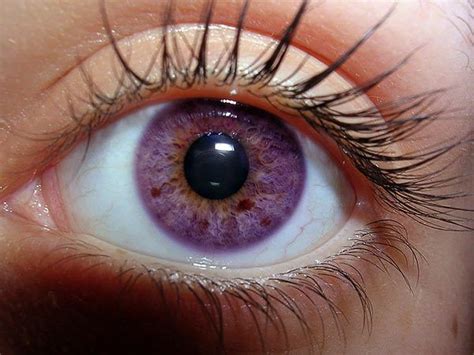 Heterochromia | Violet eyes, Eye close up, Rare eye colors