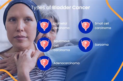 Bladder Cancer Treatment: Everything You Need To Know | ACTC