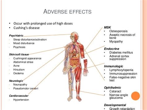 Systemic steroid therapy