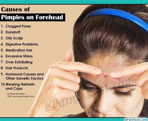 Causes of Pimples on Forehead #PimplesUnderTheSkin #PimplesExtraction #bodyacne | Pimples on ...