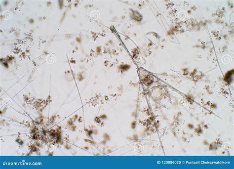 Marine Aquatic Plankton Under the Microscope View Stock Photo - Image of animal, food: 120886020