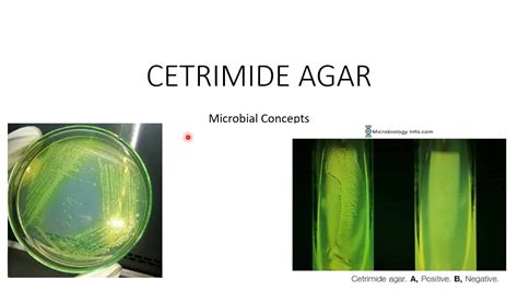 cetrimide agar | Pseudomonas aeruginosa | Microbiology basics - YouTube