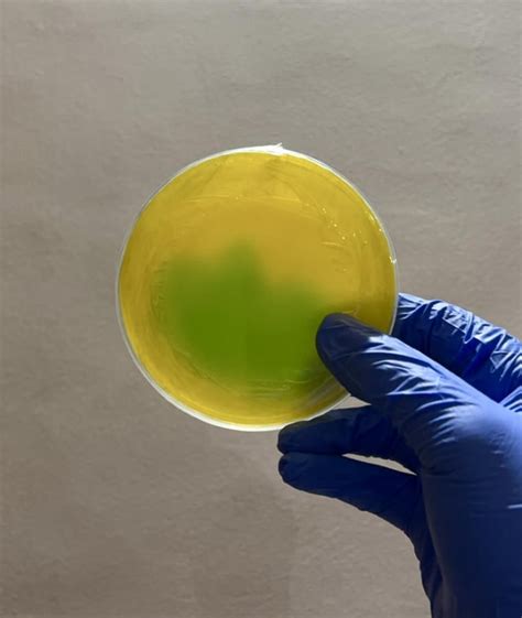 Multicoloured Agar Plates 🧫 : r/Agarporn