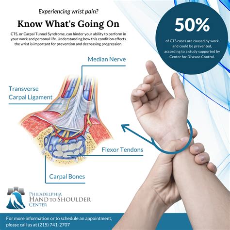 What Is Carpal Tunnel Syndrome? - Philadelphia Hand to Shoulder Center