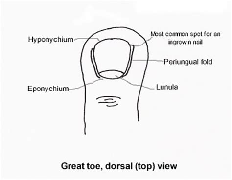 Toe Nail Injuries | Causes and treatment options | MyFootShop.com