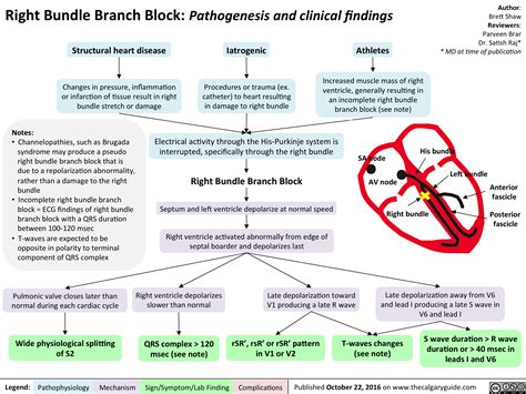 Right Bundle Branch Block: Pathogenesis and clinical findings | Calgary Guide