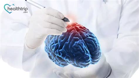 Navigating Neurosugery: Understanding Risks and Benefits for Informed ...