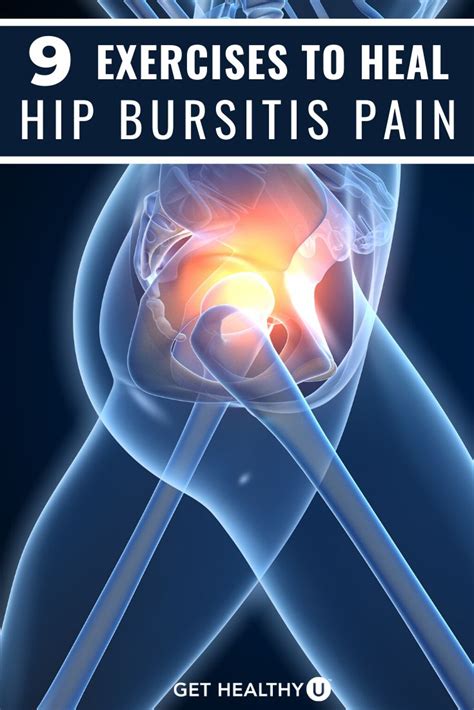 Anterior Hip Bursitis