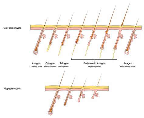 Alopecia Treatment | HPIHair Partners