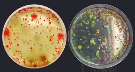 Agar Plate Bacterial Identification Chart