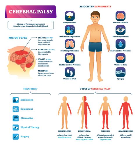 Athetoid Cerebral Palsy | Free Consultation