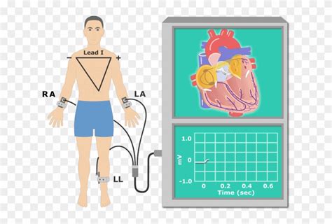 The P Wave Ekg Recording Animation Slide - Ecg Cartoon Clipart (#619108 ...