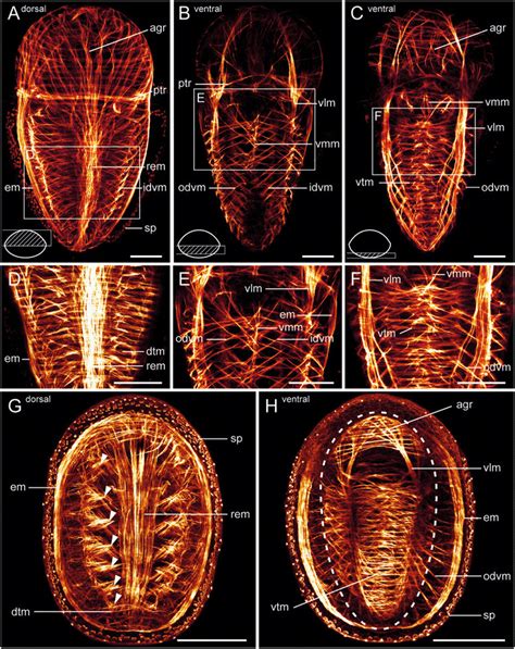 Late larval and early juvenile myoanatomy of Leptochiton asellus (Polyplacophora). Apical ...