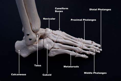 5th metatarsal fractures - Newcastle Physiotherapy