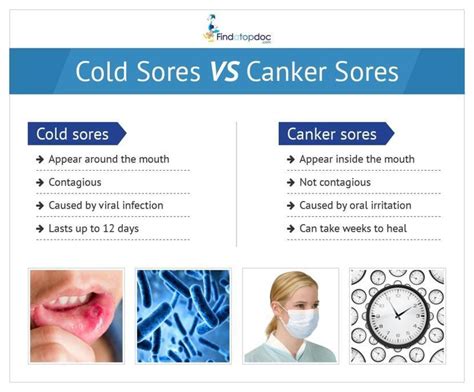 Cold Sores vs. Canker Sores