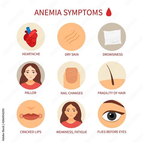 Vector medical poster anemia. Symptoms of the disease. Stock Vector ...