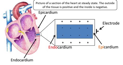 The T-Wave Explained - What Do T Waves On An ECG Represent?