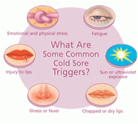 Why you get cold sores, and 4 ways to deal