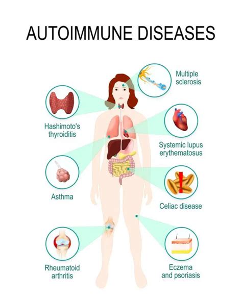 Immune System Diseases: Types, Symptoms, Prevention | STD.GOV Blog