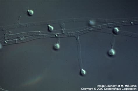 The dimorphic fungi Flashcards | Quizlet