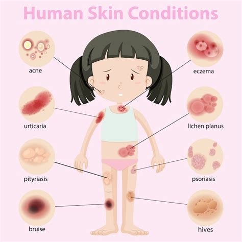 Free Vector | Diagram showing human skin conditions