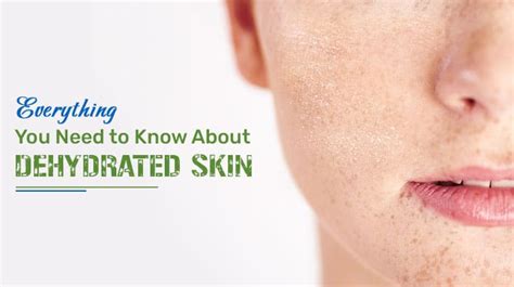 Everything You Need to Know About Dehydrated Skin