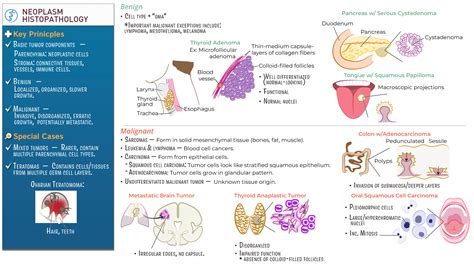 Histology: Neoplasm Histopathology | ditki medical & biological sciences