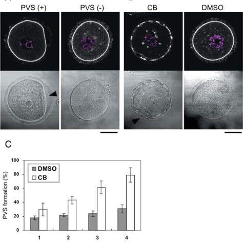 Formation of the perivitelline space (PVS) in mouse oocytes during in... | Download Scientific ...