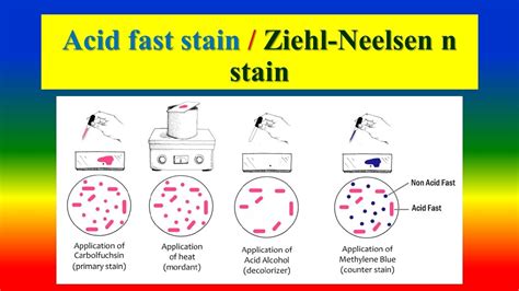 Ziehl-Neelsen Staining- Principle And Procedure With, 58% OFF